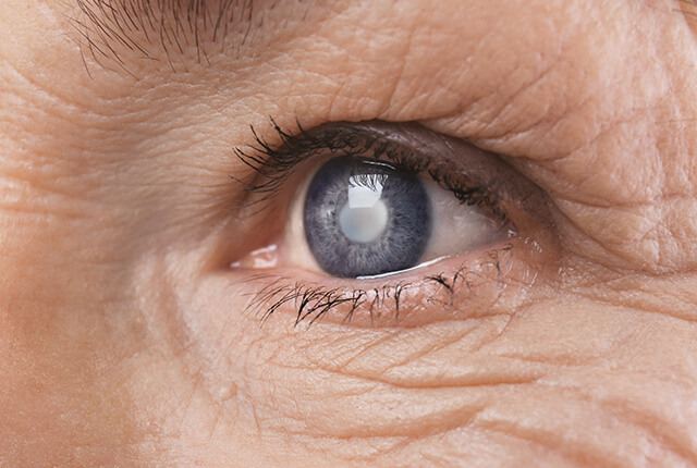 高齢女性の目の拡大写真