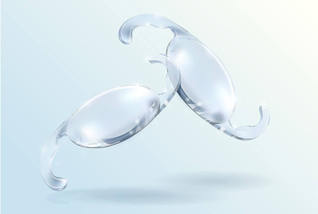 眼内レンズのイメージ図